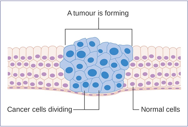 1급 발암물질이 체내에 흡수되었을 때, 종양이 형성되는 과정을 나타내는 그림. 사진=페이스북/굿모닝충청 정문영 기자